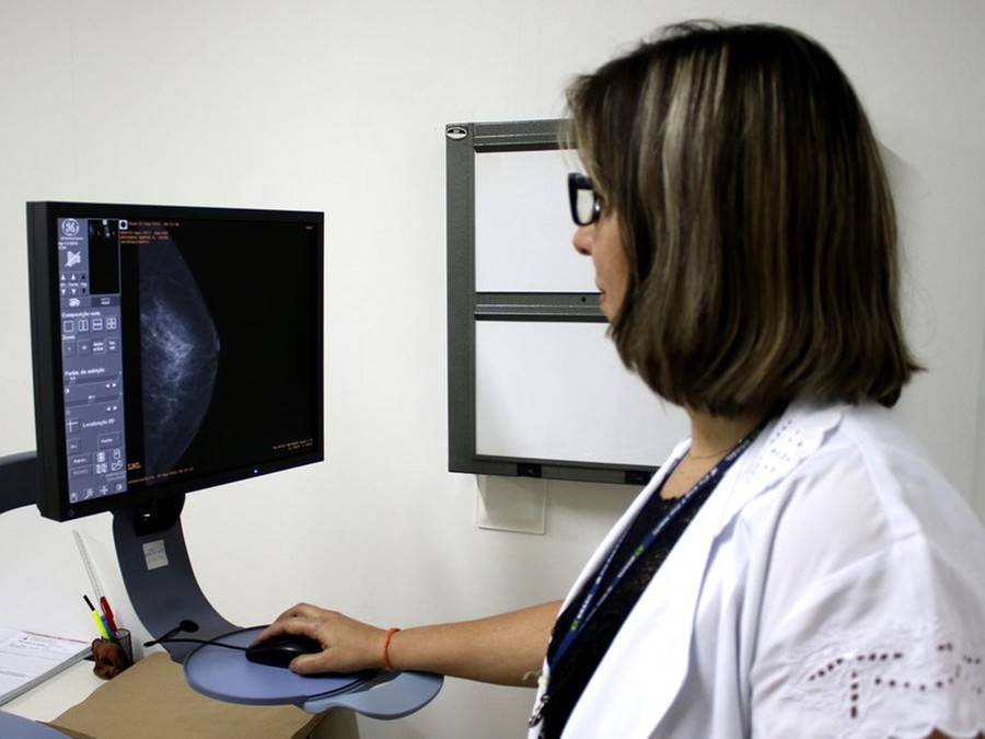 Apenas metade das mulheres com idade entre 40 e 49 anos fez mamografia nos últimos 18 meses Apenas metade das mulheres com idade entre 40 e 49 anos fez mamografia nos últimos 18 meses