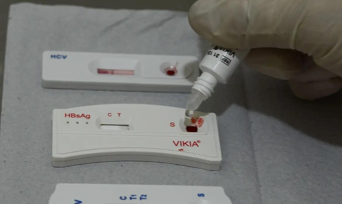 Taxa de detec&ccedil;&atilde;o de HIV gera alerta