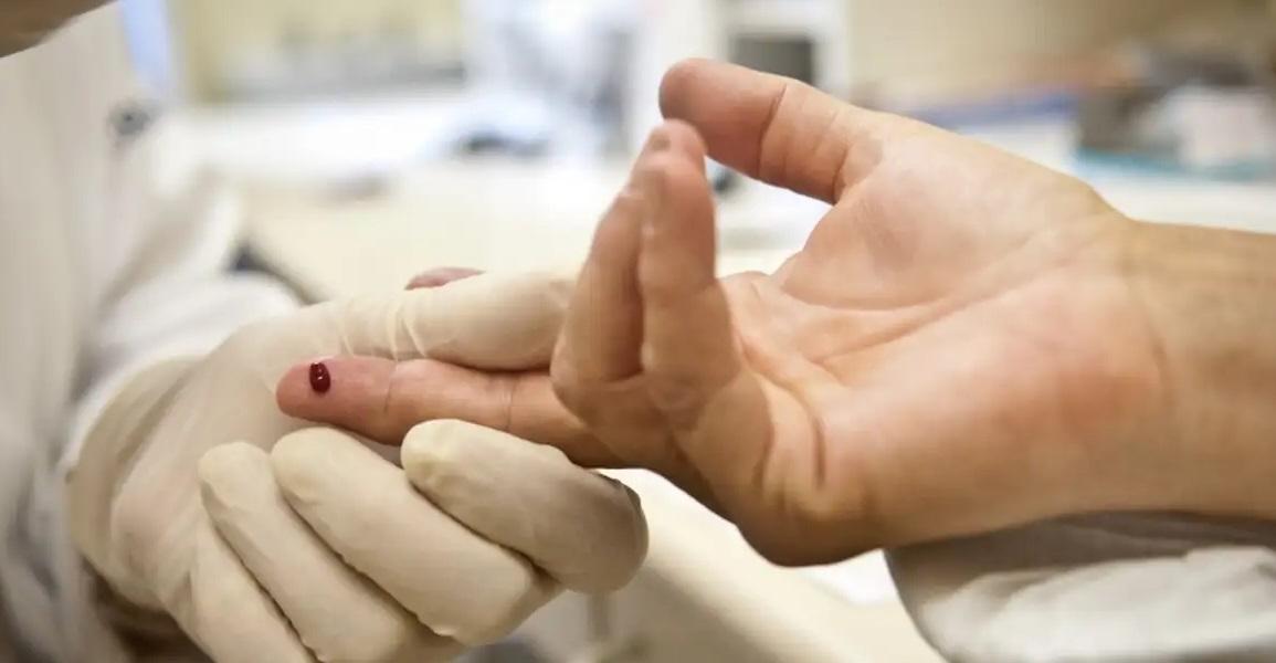 Casos de s&iacute;filis e de HIV/aids aumentam entre homens jovens