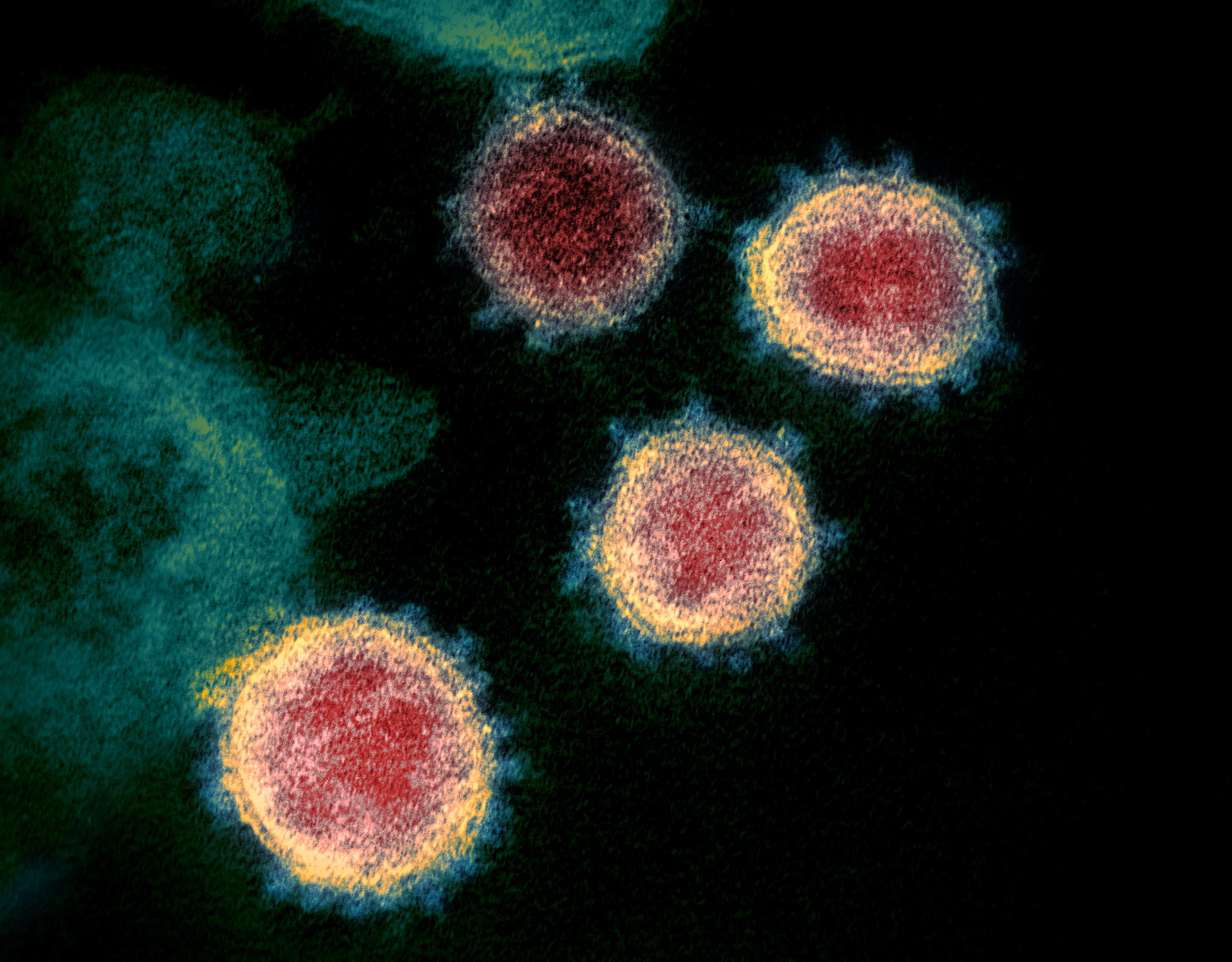 Tratamento contra Covid-19 da Immunome neutraliza variantes em teste pr&eacute;-cl&iacute;nico