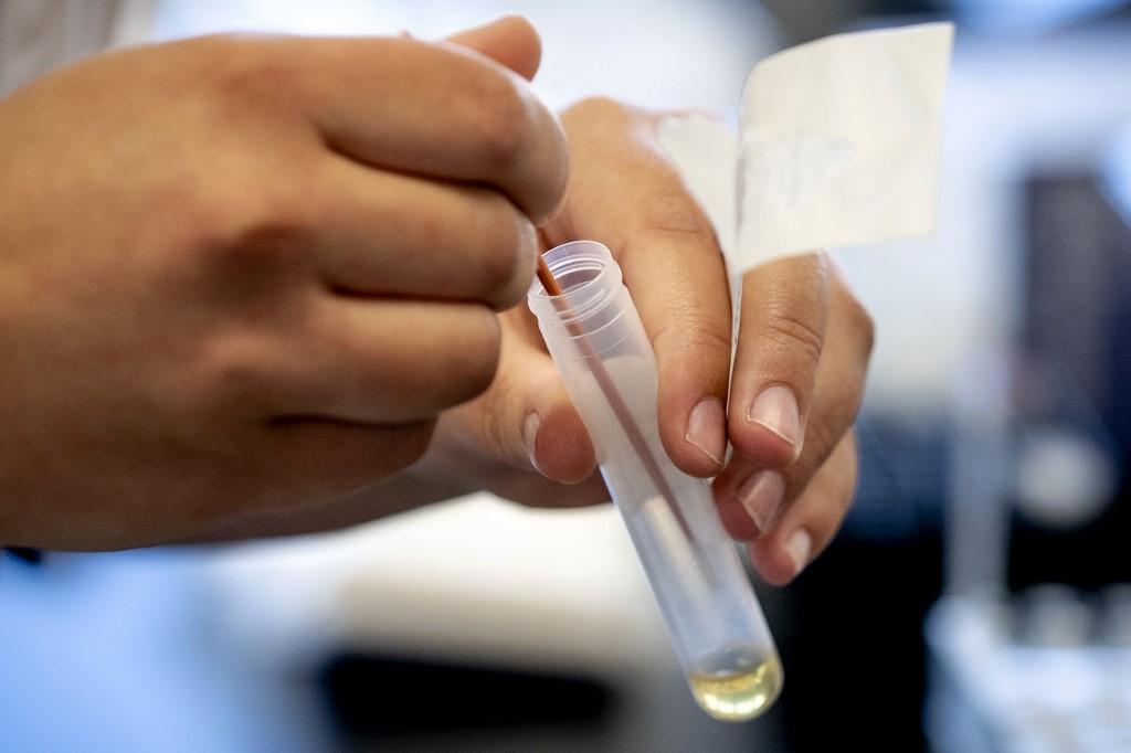 Exame ser&aacute; analisado para identificar o tipo de variante