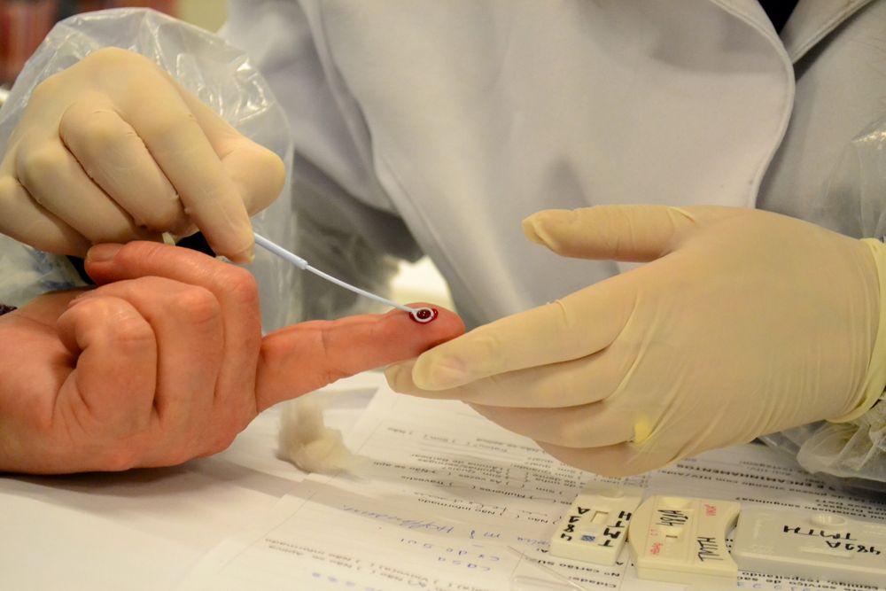 Em 2022, o pa&iacute;s registrou 43.403 novos casos de HIV, destes, 73,6% em homens e 26,3% em mulheres