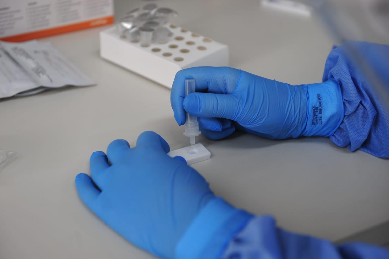 Nos &uacute;ltimos meses, carga viral teve aumento significativo, mas casos confirmados permaneceram baixos