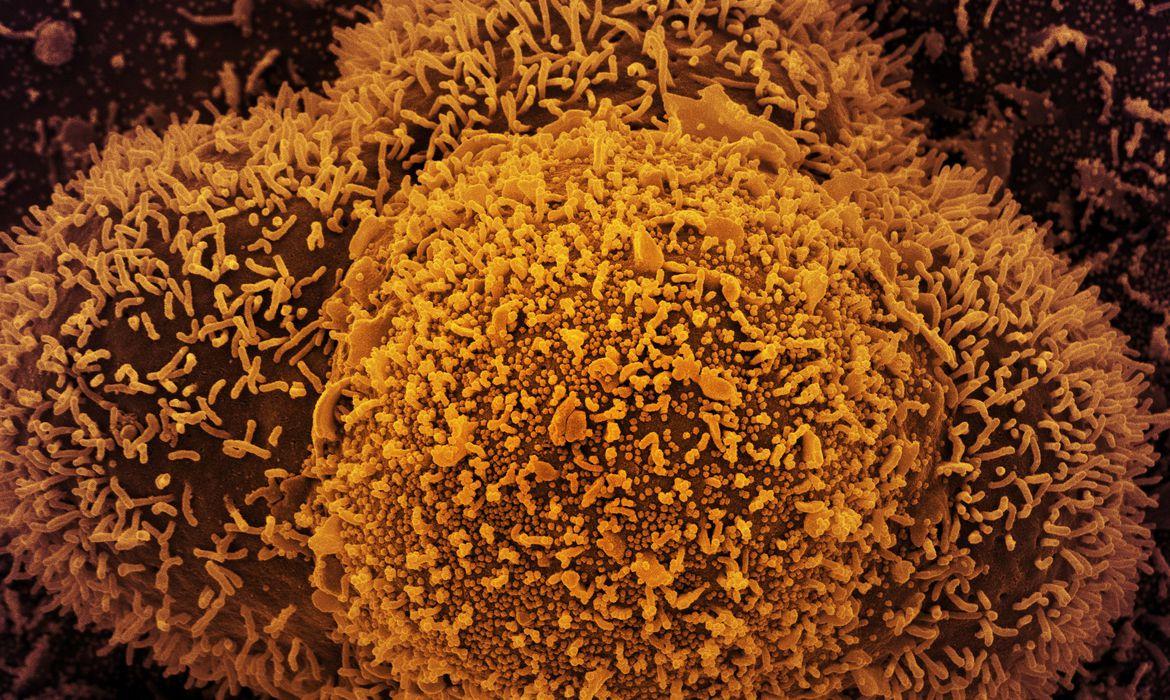 Os resultados foram comparados com um grupo de controle com 52 crian&ccedil;as