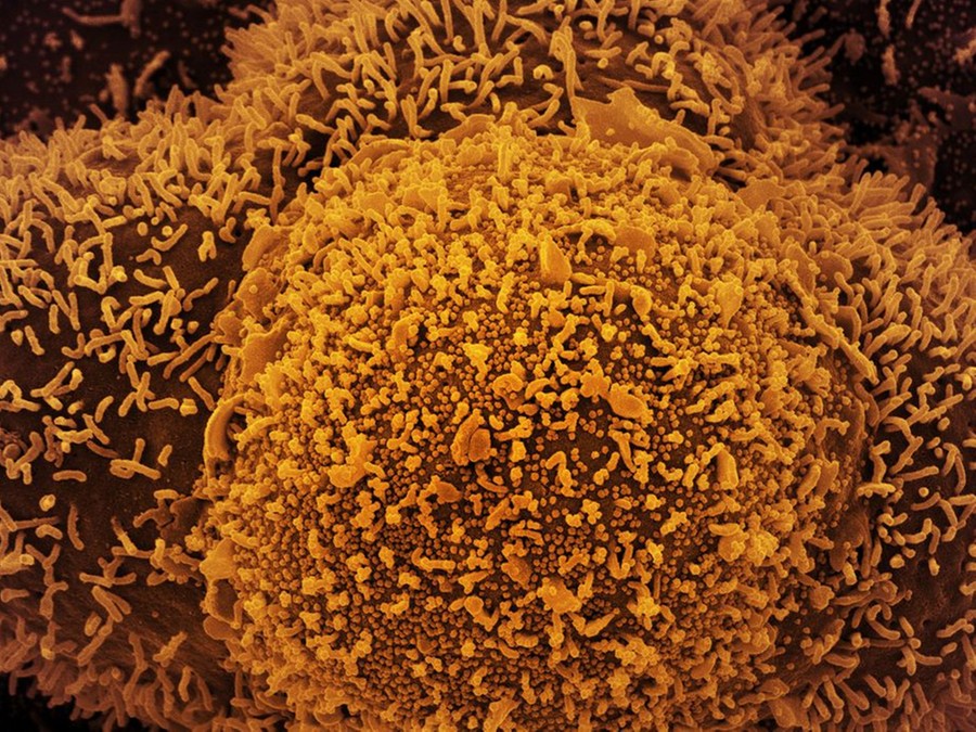 Os resultados foram comparados com um grupo de controle com 52 crianças Os resultados foram comparados com um grupo de controle com 52 crianças