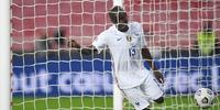 Kanté é o terceiro volante da seleção francesa a se machucar com gravidade